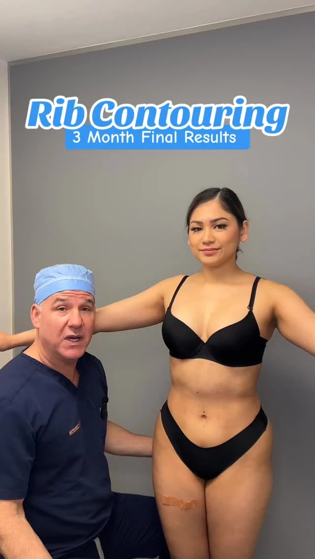 THREE MONTHS post-rib contouring and this transformation speaks for itself. She’s lost 5 inches off her waist—and she couldn’t be happier. Just in time for summer ☀️👙
#RibContouring #SummerReady #WaistSnatched #drsterry #ribcontouring #ribbending #ribxcar #plasticsurgerywithpurpose #plasticsurgerynyc #bodycontouring #invisarib #results