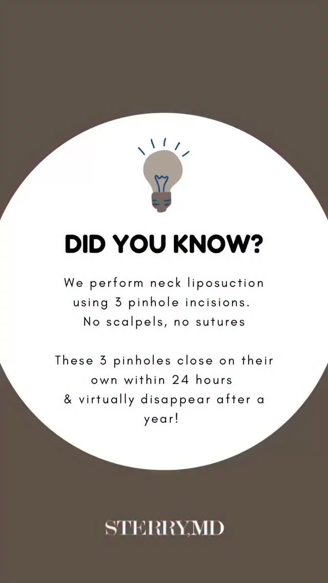 Do you know how we perform lipo? 👀 It’s not just about removing fat — it’s about precision, contour, and protecting your natural anatomy for smooth, natural-looking results! 
#drsterry #plasticsurgery #lipo #necklipo #chinlipo