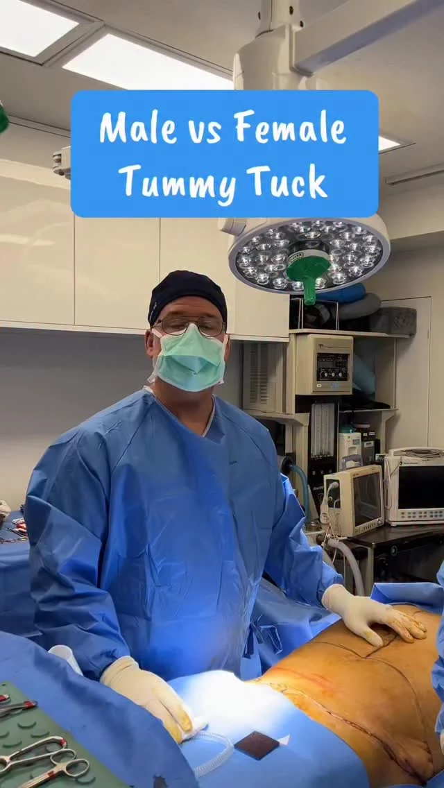Male and female tummy tucks are approached differently — from muscle repair to contouring and scar placement — but the goal is always the same: a stronger core and a more confident silhouette. Every body deserves a customized plan!💪✨

#maletummytuck #difference #nycplasticsurgeon #realpatients