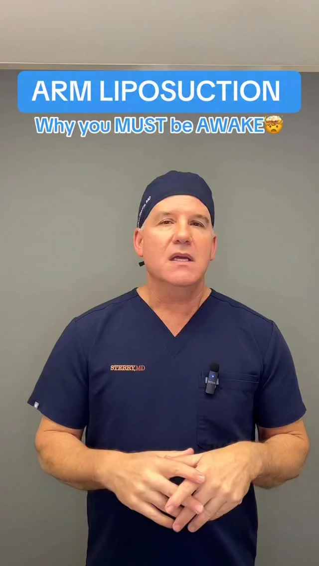 Arm lipo is performed awake — and that’s intentional. It allows for safer, more precise contouring and better overall results!💪
#nycplasticsurgeon #drsterry #armlipo #liposuction