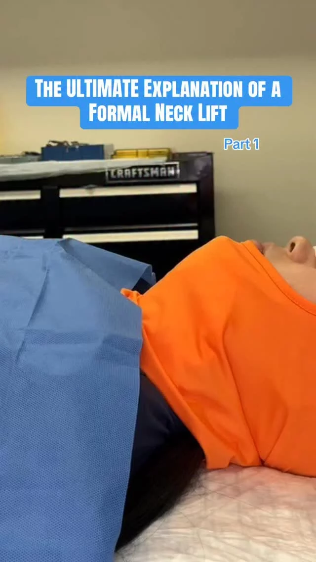 A formal neck lift isn’t just skin tightening. We address deep fat, muscle banding, and loose skin to truly redefine the jawline and neck.

Part 2, 3, & 4 are coming! 

📞 +1 (646) 624-0923 for questions or consultations.

#necklift #nycplasticsurgeon #drsterry #jawline