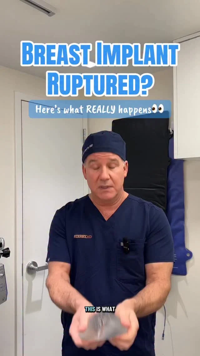 It’s not always as dramatic as you think…

Saline implants deflate quickly—you’ll notice the change almost right away.

Silicone implants? Often “silent.” No pain, no obvious signs.

That’s why routine check-ups matter. If something feels off—shape, firmness, discomfort—don’t ignore it!👀🍒

 #drsterry #plasticsurgery #implants #rupturedimplant
