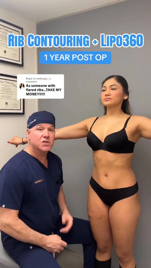 1 year post-op and still snatched ⏳✨ Rib contouring isn’t just a quick change—it’s a long-lasting transformation. With proper aftercare, the shape holds beautifully over time.

📞 +1 (646) 624-0923 to book your consultation! 

#ribcontouring #ribxcar #nycplasticsurgeon #drsterry