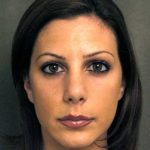 Rhinoplasty Before & After Patient #1579