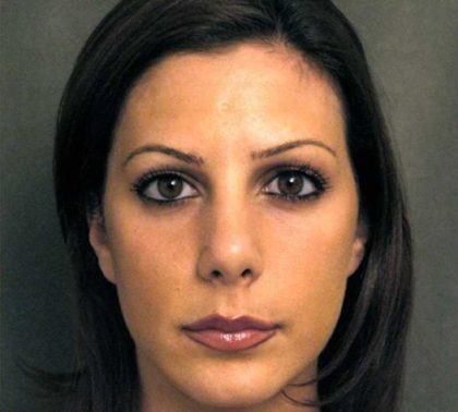 Rhinoplasty Before & After Patient #1579