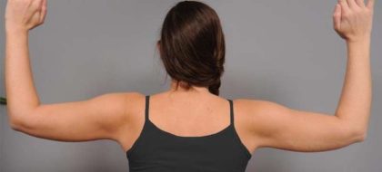 Liposuction Before & After Patient #768