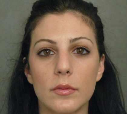 Rhinoplasty Before & After Patient #1579